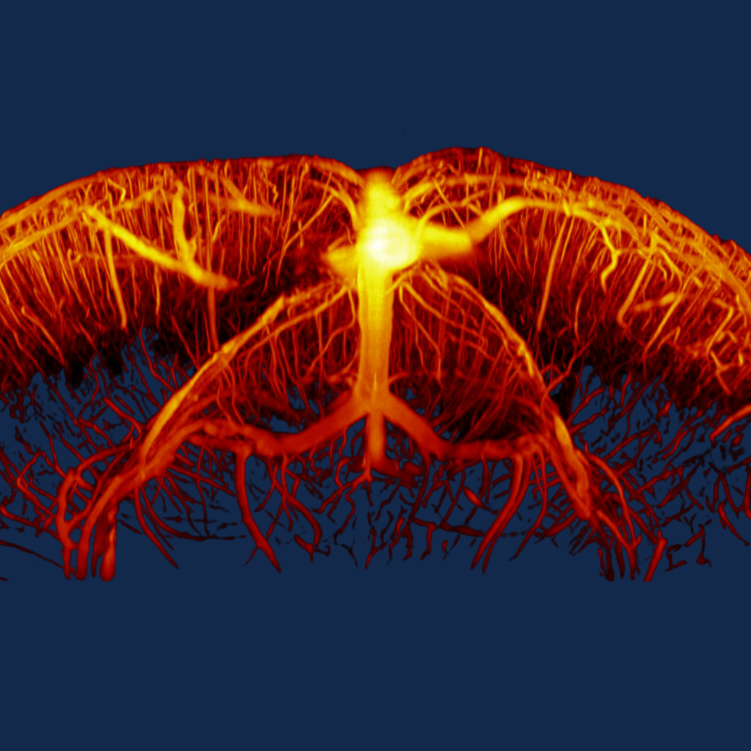 &amp;lt;em&amp;gt;3D volumetric ultrasound captures&amp;amp;nbsp;data on both depth and motion in real time. This example shows the network of tiny blood vessels in a mouse brain.&amp;lt;/em&amp;gt;