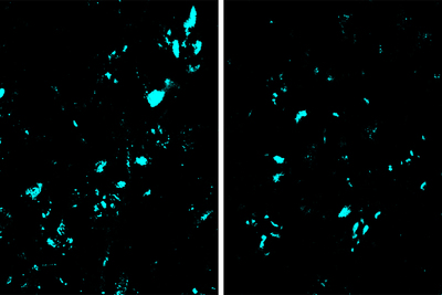 CRISPR base editing decreased the amount of a mutant protein (blue) that contributes to ALS in the spinal cord. Left, a spinal cord section from an untreated mouse. Right, a spinal cord section from an animal treated by base editing. Image courtesy of Thomas Gaj