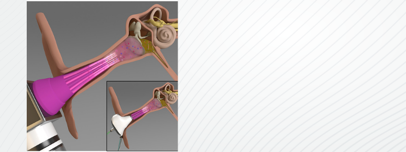 Study tests microplasma against middle-ear infections