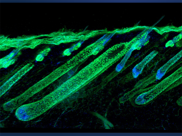 Image of a hair follicle, incuded in the article, â€œHedgehog signaling reprograms hair follicle niche fibroblasts to a hyper-activated state,â€œ published in Developmental Cell.