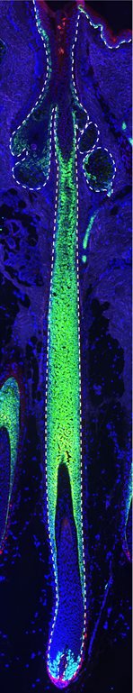This is a human scalp hair follicle stained with the following markers:Green for KRT14 mRNA. The cyan color for KI67 mRNA. The red color for SCUBE3 mRNA. Image by Dr. Yingzi Liu.