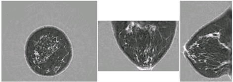 &amp;lt;em&amp;gt;Images showing coronal, axial, and sagittal speed of sound images of the breast, taken with the QT Imaging scanner.&amp;lt;/em&amp;gt;