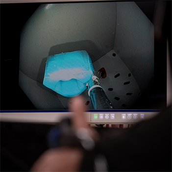 &amp;lt;em&amp;gt;GI endoscopy tools allow surgeons to visualize hollow internal organs.&amp;lt;/em&amp;gt;