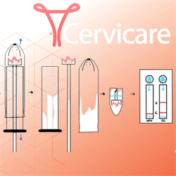&amp;lt;em&amp;gt;Cervicare, is a rapid bedside screening test to detect biomarkers for cervical cancer.&amp;lt;/em&amp;gt;