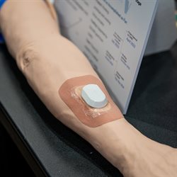 Auvi seeks to provide continuous fistula monitoring for end-stage renal disease patients with an arteriovenous fistula. The product will use a patch-like sensor to collect auditory information to monitor for&amp;amp;amp;amp;amp;amp;nbsp;AVF narrowing, thus informing clinical decision-making, reducing healthcare costs, and improving patient outcomes.