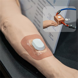 &amp;lt;em&amp;gt;Auvi seeks to provide continuous fistula monitoring for end-stage renal disease patients with an arteriovenous fistula. The product will use a patch-like sensor to collect auditory information to monitor for&amp;amp;nbsp;AVF narrowing, thus informing clinical decision-making, reducing health care costs, and improving patient outcomes.&amp;lt;/em&amp;gt;